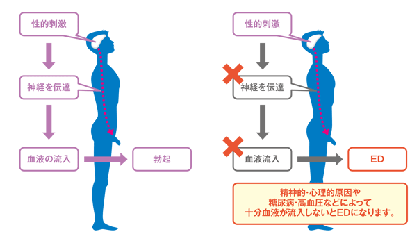 勃起力アップの運動】勃たない男子必見!! 勃起力回復のカギはスクワットにあり！最強の勃起トレーニングを大公開!! – サコダ・レディースクリニック