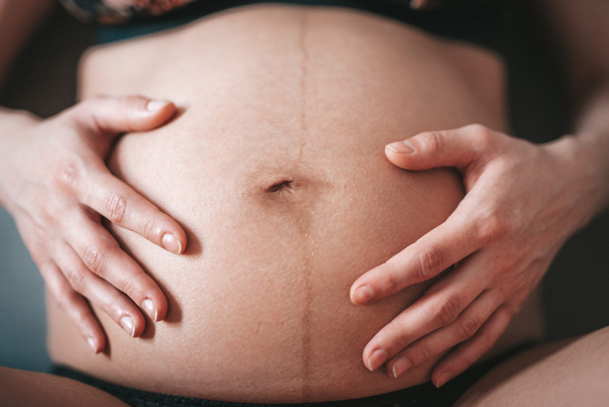 赤い妊娠線は治る?初期のピンク~赤紫色の症状を消す手順を解説
